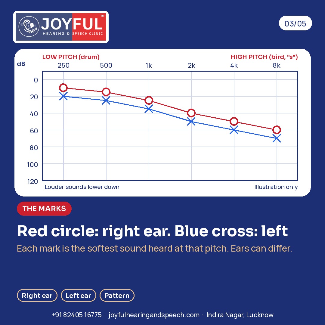 An illustrated example audiogram with red circles for the right ear and blue crosses for the left ear. Illustration only.