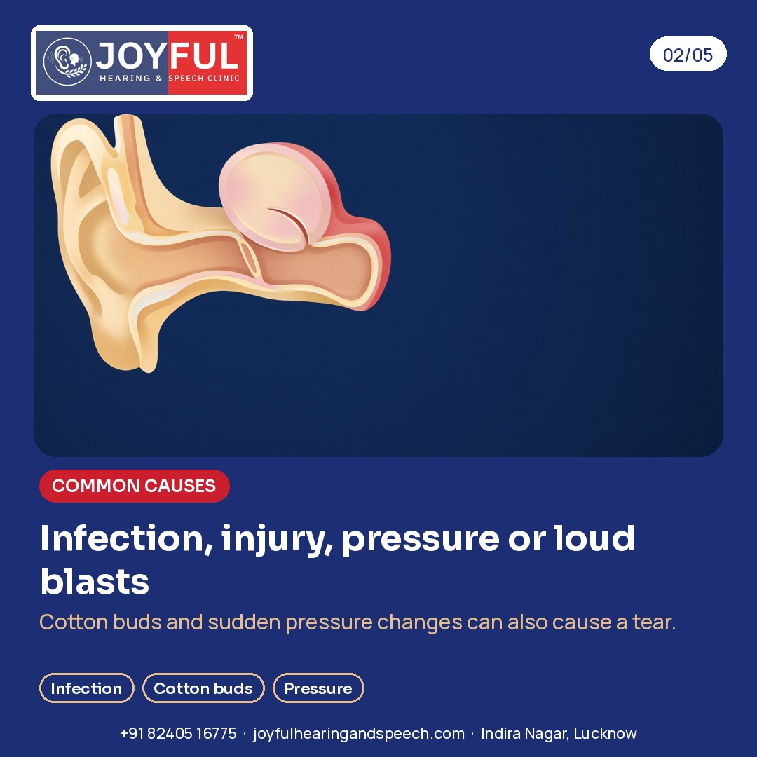 A simple drawing of the ear canal and an eardrum with a small tear. Infection, injury, pressure or loud blasts. Cotton buds and sudden pressure changes can also cause a tear.